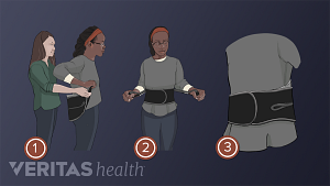 Medical illustration of 3 steps on how to put on a back brace